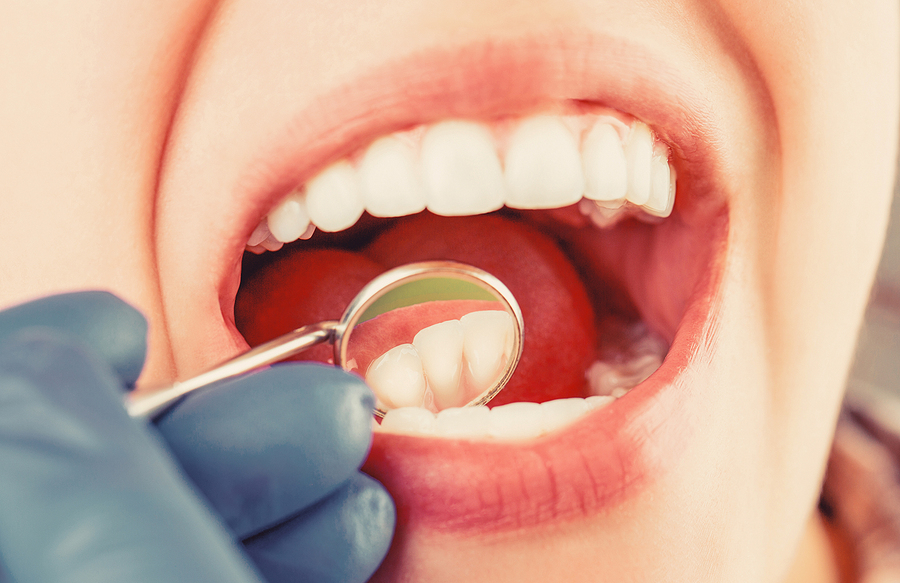 Don’t Ignore These 5 Warning Signs: When to Consider a Root Canal