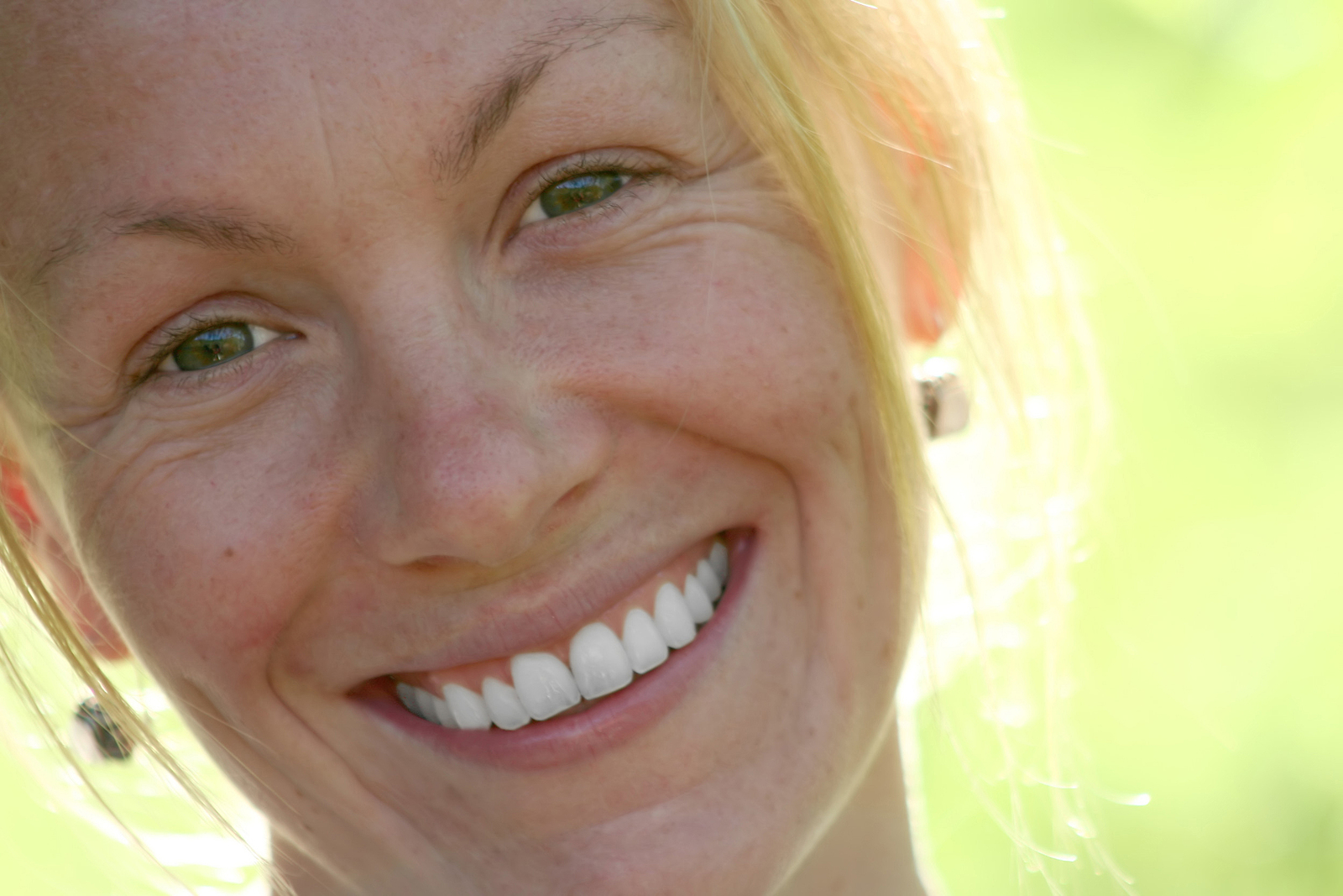 Transform Your Smile with a Smile Makeover in Renton, WA